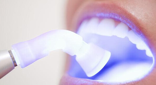 Cosmetic Dentistry Fort Worth