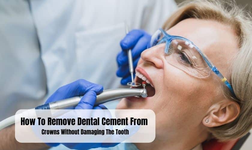 How To Remove Dental Cement From Crowns Without Damaging The Tooth