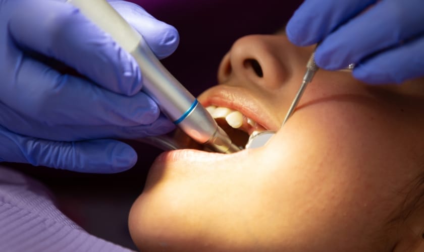 dry socket after tooth extraction