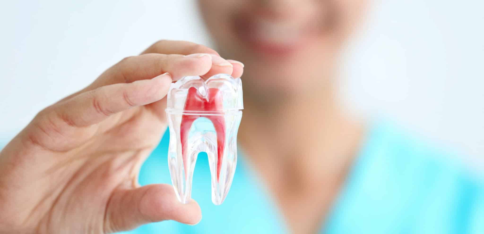 Root Canal Procedure What Are the 5 Basic Steps?