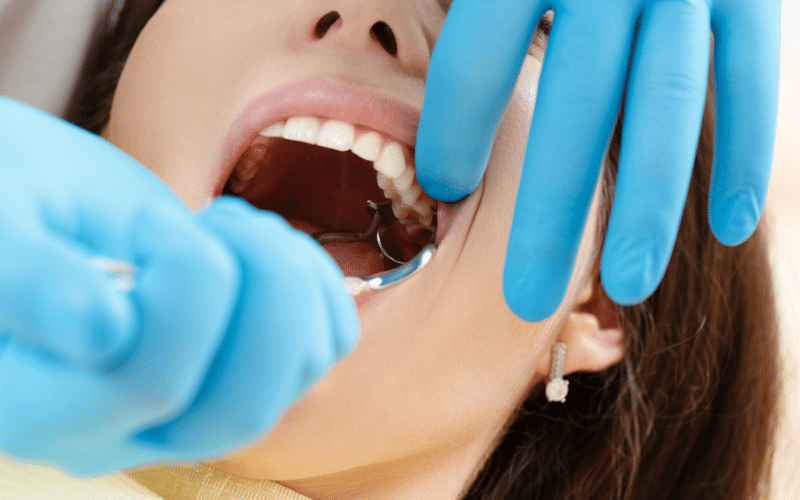 What To Expect During a Tooth Extraction Procedure