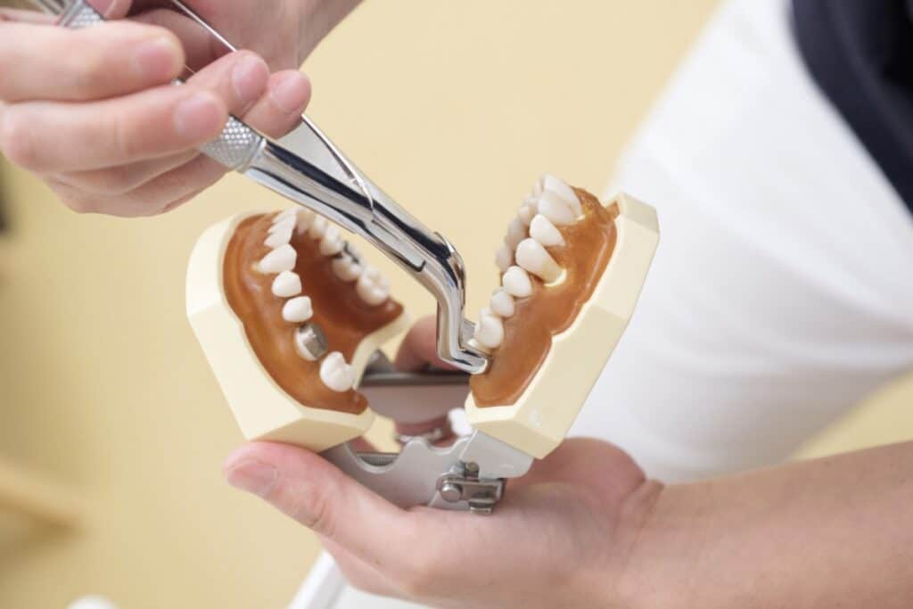 Tooth-Extraction-in-Haltom-City