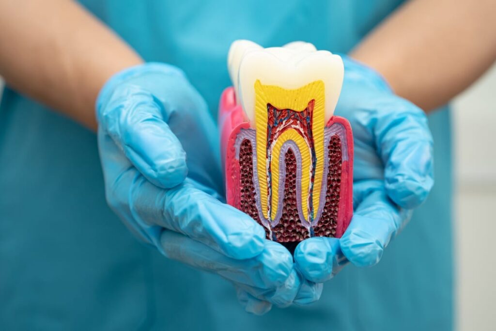 Root Canal Treatment in Haltom City