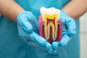 Root Canal Treatment in Haltom City