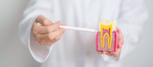 Root Canal Treatment in Keller